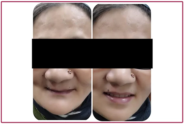 Treatment Pictures