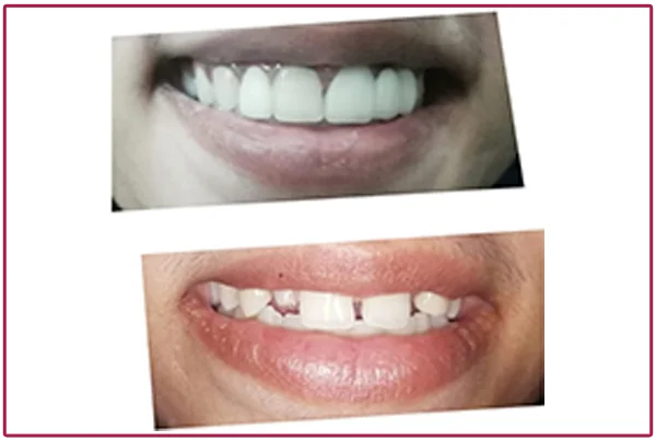 Treatment Pictures