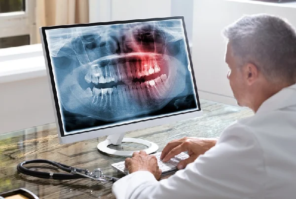 Digital X Ray