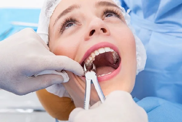 Wisdom Tooth Surgery