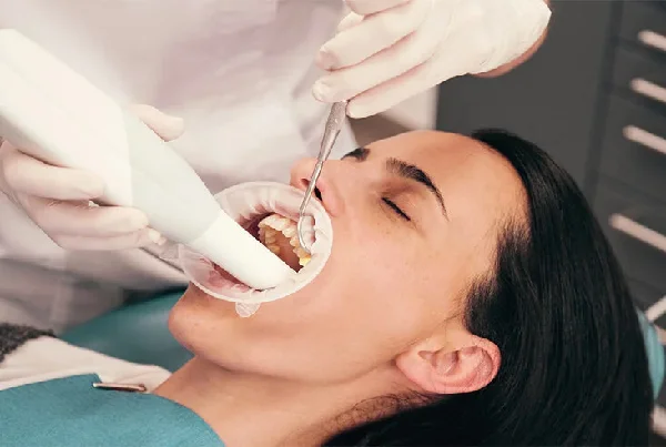Deep Teeth Cleaning
