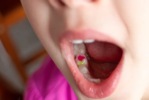 Multi Coloured Filling For Children